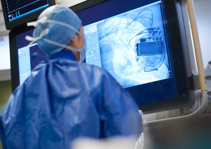 Lead Extraction Conditions & Treatments UT Southwestern Medical Center