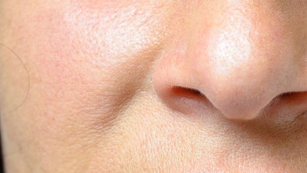 treatment for inverted nasal papilloma