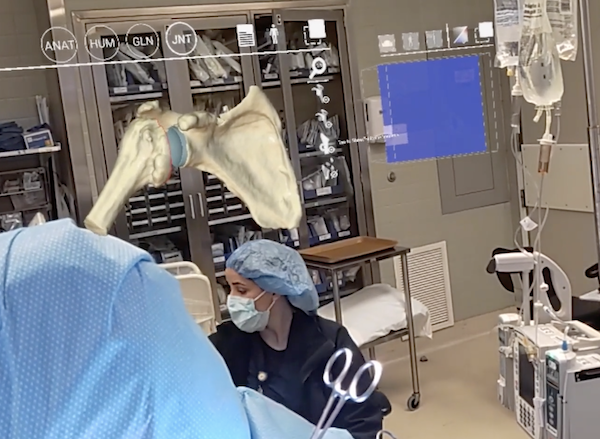 Augmented reality in a surgical setting with shoulder anatomy overlay.