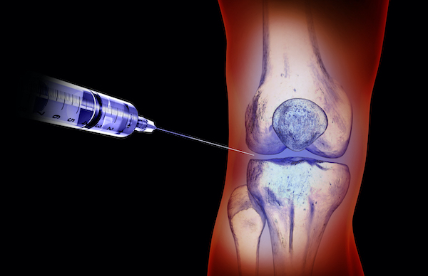 stem cell therapy injections