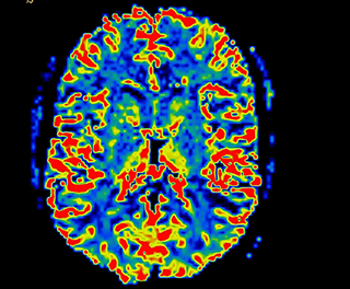 Peter O'Donnell Jr. Brain Institute