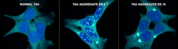 dr-diamond-tau-600.jpg