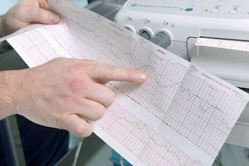 What Fetal Heart Rate Monitoring Can And Can T Tell Us Your Pregnancy Matters Ut Southwestern Medical Center