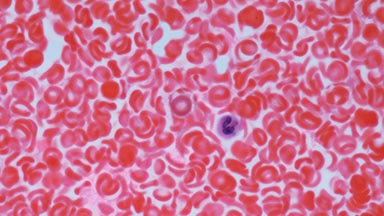 University Hospital Medical Oncology Clinic - Head & Neck