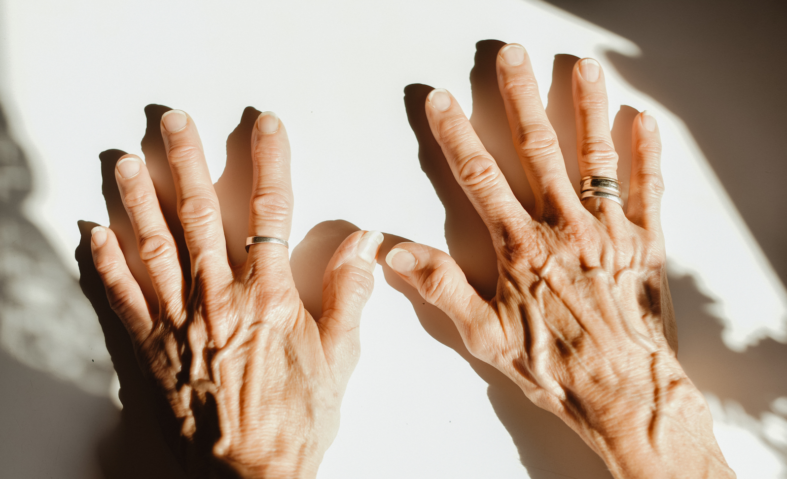 UT Southwestern Medical Group at Central Dallas Rheumatology Dallas