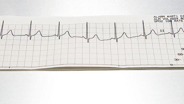 Transesophageal and Transthoracic Echocardiograms