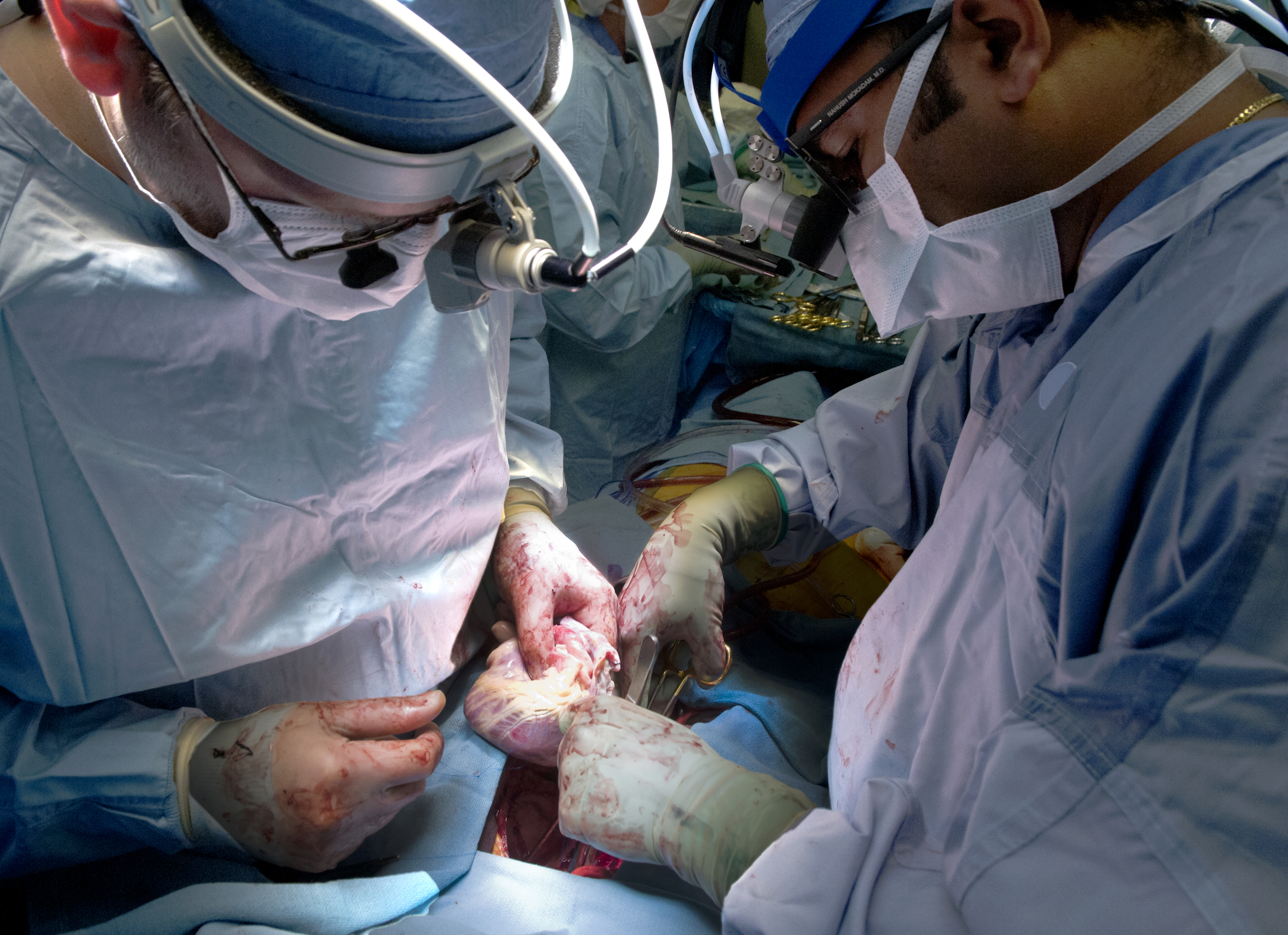 After Months On Portable Artificial Heart Alaska Man Receives Transplant Uw News After Months On Portable Artificial Heart Alaska Man Receives Transplant Uw News