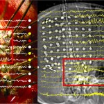 EEG superimposed over images of a brain.