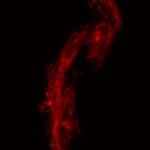 TB cording in zebrafish