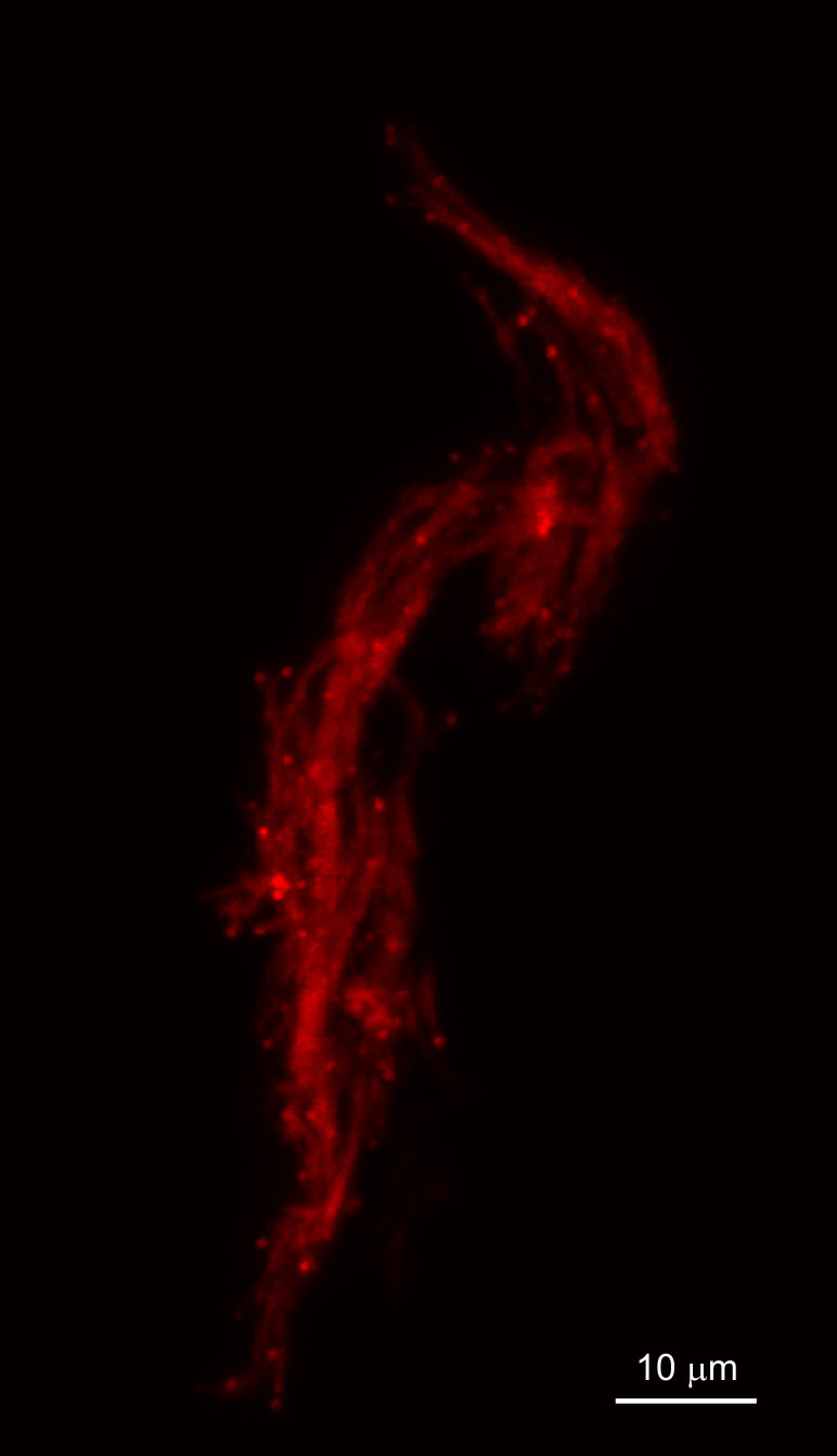 TB cording in zebrafish