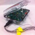 The portable device tracks how much a person’s limb swells and shrinks when inside a prosthetic socket.