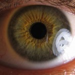 A human eye.
