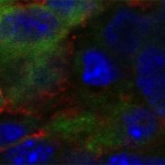 A stained cross-section of a mouse tumor. In this image, red areas are macrophages, and green indicates the presence of the peptide that can bind with macrophages in cancer cells.