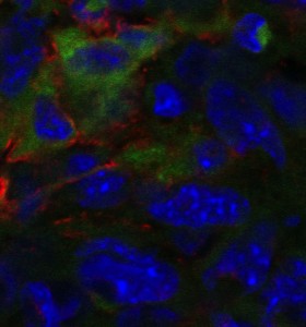 A stained cross-section of a mouse tumor. In this image, red areas are macrophages, and green indicates the presence of the peptide that can bind with macrophages in cancer cells.