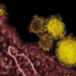 MERS virus