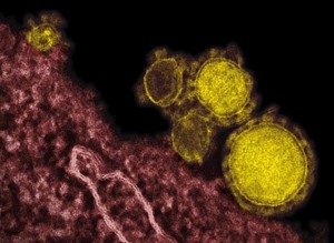 MERS virus