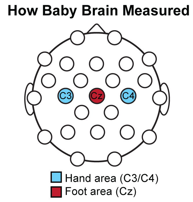 Drawing showing the hand and foot areas of the babies brains.