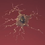 damaged brain cell Alzheimer's