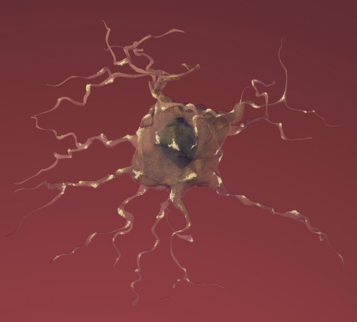 damaged brain cell Alzheimer's