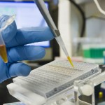 diabetes research