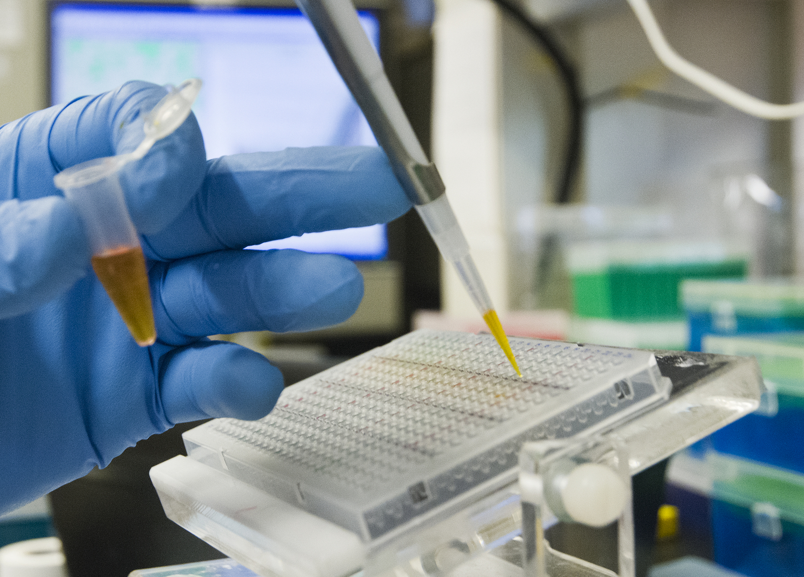 diabetes research