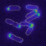 bacterial cells split