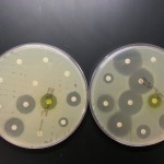 E. coli