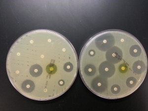 E. coli