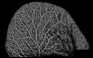 a mouse ear's veins and blood vessels are shown in high resolution using the UW's new imaging technique.
