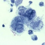 herpes simplex virus