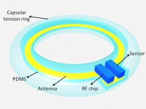 An illustration of the final device. The device would be placed in an artificial lens with its antenna circling the perimeter, and the sensor and radio frequency chip inside.