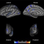 brain scan image