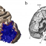 Drawing of brain