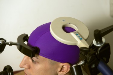 A transcranial magnetic stimulation coil