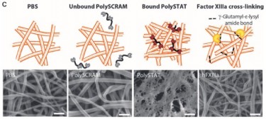 a comparison of bondings