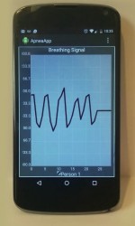 ApneaApp captures a sleeping person's breathing signals to detect apnea events.