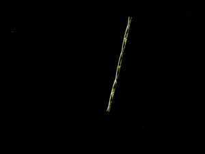 spiky cell on black background