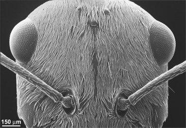 A scanning electron microsocope (SEM) view of the Saharan silver ant's head densely covered in hairs.