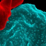 Malaria parasites infecting a red blood cell.