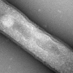 The study looked at Thaumarchaeota archaea, which are found throughout the world's oceans. These single-celled organisms have just one membrane sac that encloses their bodies. This organism, used in the study, was collected from a tropical-water tank at the Seattle Aquarium.