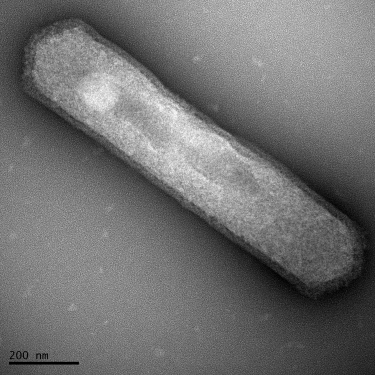 The study looked at Thaumarchaeota archaea, which are found throughout the world's oceans. These single-celled organisms have just one membrane sac that encloses their bodies. This organism, used in the study, was collected from a tropical-water tank at the Seattle Aquarium.