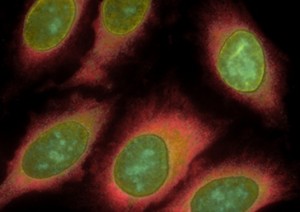 HeLa cells stained with antibodies