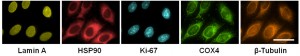 HeLa cells stained with antibodies