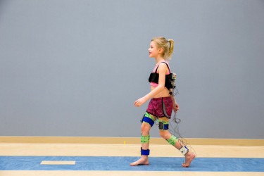 Walk-DMC is a new, quantifiable measure of motor control in children with cerebral palsy. It relies on data from electromyography (EMG) shown in this demonstration, which uses electrodes to monitor muscle activity.