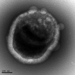 A single cell of the low-oxygen zone bacterium grown in the UW lab, as seen under an electron microscope.