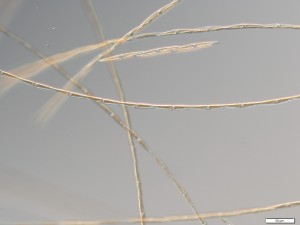 long chains of cells