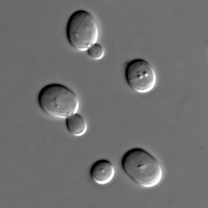 Yeast cells under a microscope.