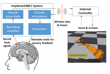 The UW study is based on the concept of closed-loop “bi-directional brain-computer interfaces” (BBCIs) being developed at the CSNE. These devices can both record from and stimulate the nervous system to help restore movement and promote plasticity for rehabilitation.