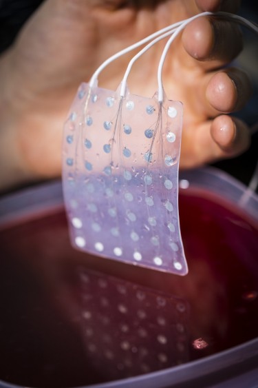 This type of electrocorticography (ECoG) grid, which is implanted in patients about to undergo epilepsy surgery, enables researchers to record and transmit electrical signals to and from the surface of the brain.