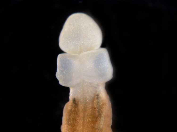 Fifteen days after being cut. A more developed head and neural tube have formed. The worm's nervous system and organ functions are restored.